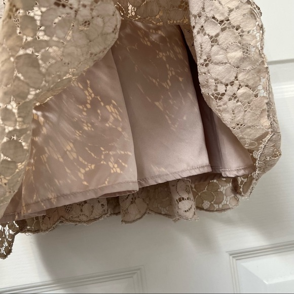 Aritzia Lace Dress Size 2 - Picture 7 of 8